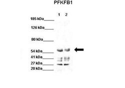 PFKFB1 Rabbit anti-Human, Polyclonal, Novus Biologicals 0.1ml; Unconjugated:Antibodies,